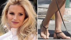 Alluce valgo di Michelle Hunziker